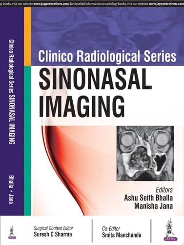 Clinico Radiological Series: Sinonasal Imaging