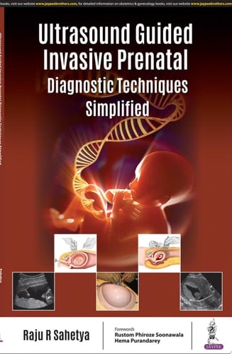 Ultrasound Guided Invasive Prenatal Diagnostic Techniques Simplified