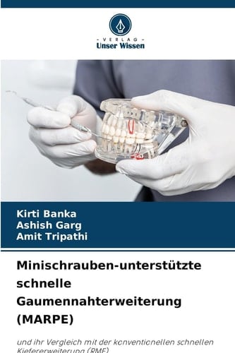 Minischrauben-unterstützte schnelle Gaumennahterweiterung (MARPE) (German Edition)