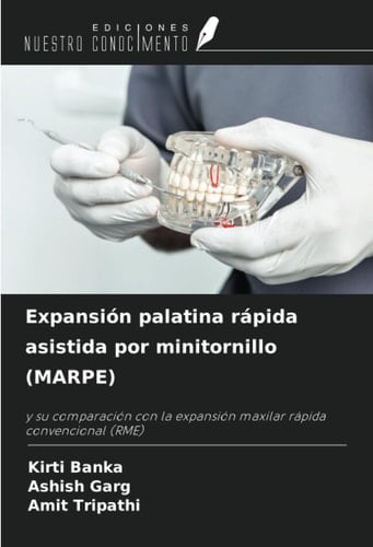 Expansión palatina rápida asistida por minitornillo (MARPE): y su comparación con la expansión maxilar rápida convencional (RME) (Spanish Edition)