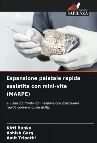 Espansione palatale rapida assistita con mini-vite (MARPE): e il suo confronto con l'espansione mascellare rapida convenzionale (RME) (Italian Edition)