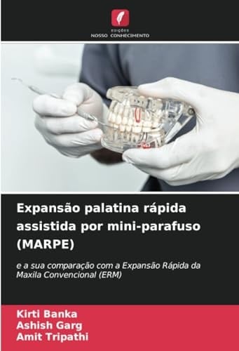 Expansão palatina rápida assistida por mini-parafuso (MARPE): e a sua comparação com a Expansão Rápida da Maxila Convencional (ERM) (Portuguese Edition)