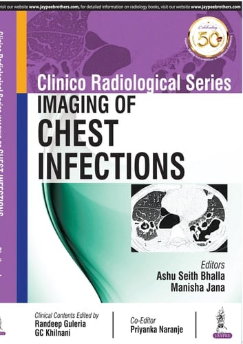 Clinico Radiological Series: Imaging of Chest Infections