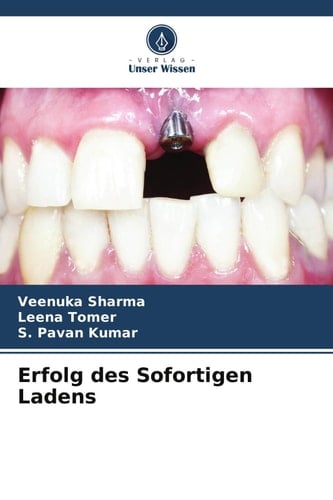 Erfolg des Sofortigen Ladens (German Edition)