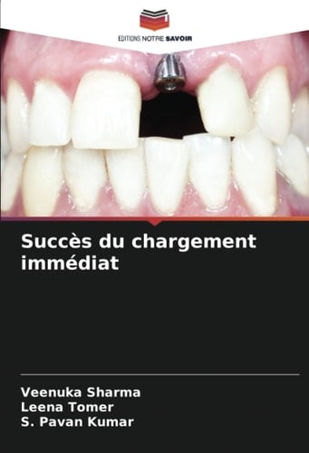 Succès du chargement immédiat (French Edition)