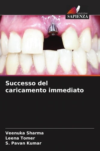 Successo del caricamento immediato (Italian Edition)