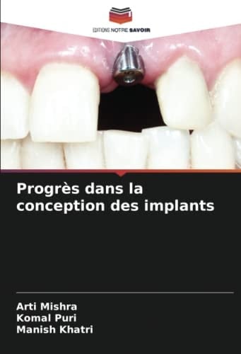 Progrès dans la conception des implants (French Edition)