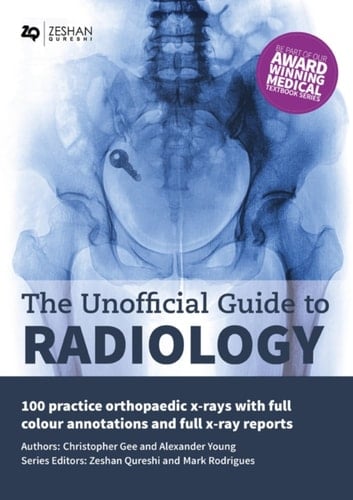 The Unofficial Guide to Radiology 100 Practice Orthopaedic X-Rays with Full Colour Annotations and Full X-Ray Reports