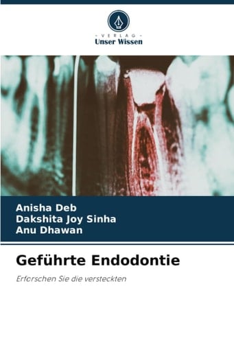 Geführte Endodontie: Erforschen Sie die versteckten (German Edition)