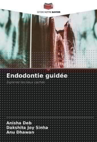 Endodontie guidée: Explorez les lieux cachés (French Edition)