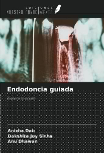 Endodoncia guiada: Explora lo oculto (Spanish Edition)