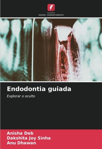 Endodontia guiada: Explorar o oculto (Portuguese Edition)