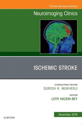 Ischemic Stroke, An Issue of Neuroimaging Clinics of North America