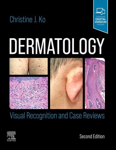 Dermatology Visual Recognition and Case Reviews