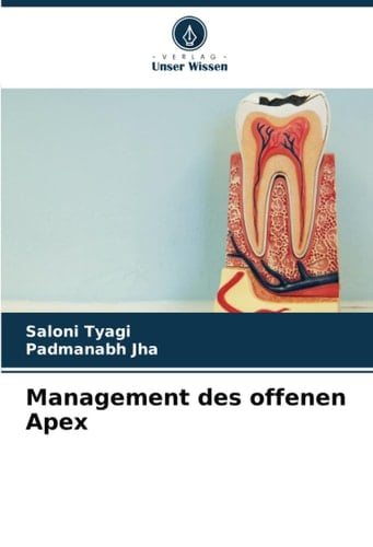 Management des offenen Apex (German Edition)
