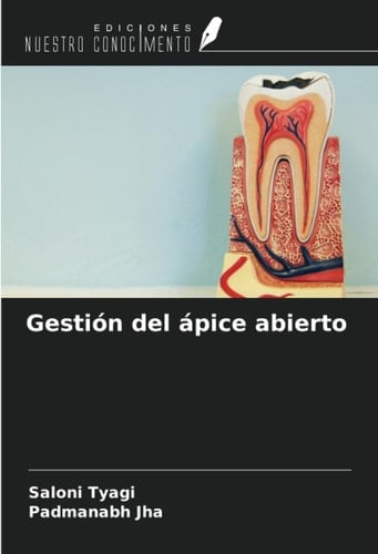 Gestión del ápice abierto (Spanish Edition)