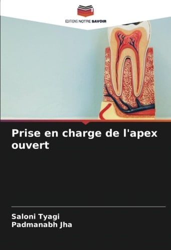 Prise en charge de l'apex ouvert (French Edition)