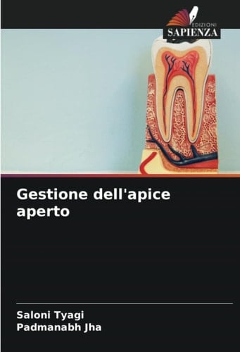 Gestione dell'apice aperto (Italian Edition)
