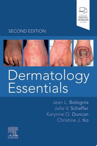 Dermatology Essentials - E-Book