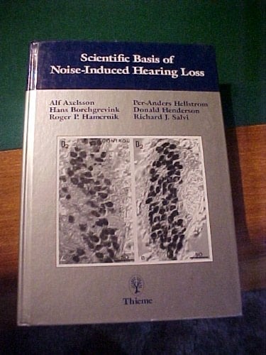 Scientific Basis of Noise-Induced Hearing Loss