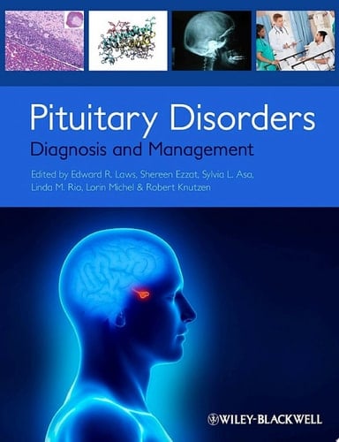 Pituitary Disorders Diagnosis and Management