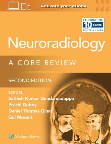 Neuroradiology A Core Review: Print + EBook with Multimedia