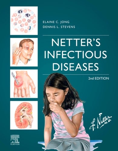 Netter's Infectious Diseases