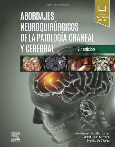 Abordajes Neuroquirurgicos Patologia Craneal Y Cerebral