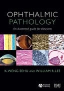Ophthalmic Pathology An Illustrated Guide for Clinicians