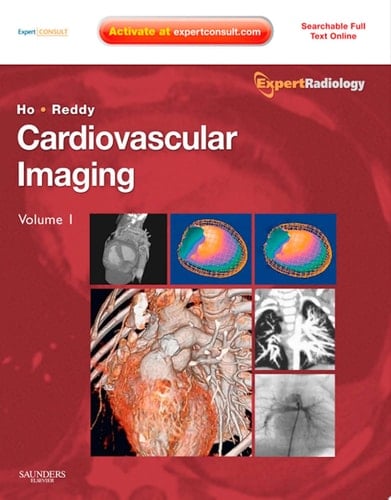 Cardiovascular Imaging E-Book Expert Radiology Series