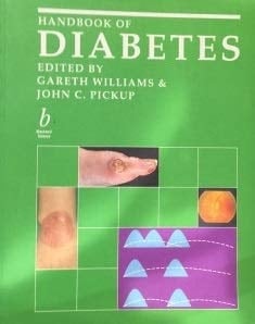 Handbook of Diabetes