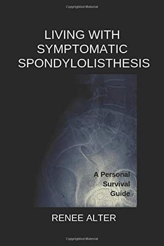 Living with Symptomatic Spondylolisthesis A Survival Guide