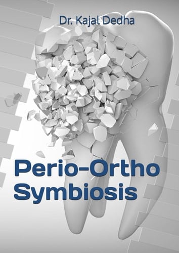Perio-Ortho Symbiosis