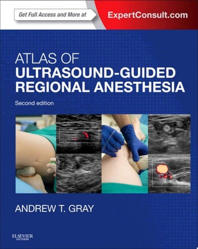 Atlas of Ultrasound-Guided Regional Anesthesia E-Book Expert Consult - Online