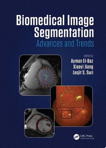 Biomedical Image Segmentation Advances and Trends