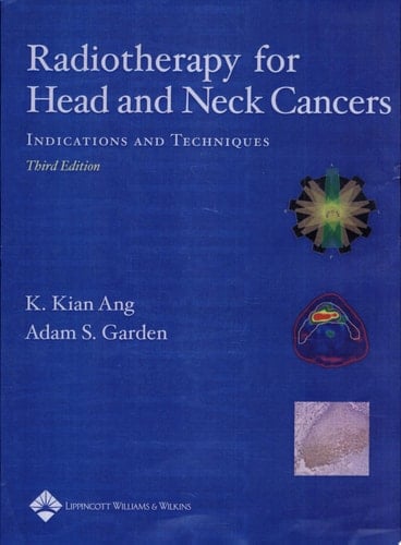 Radiotherapy for Head and Neck Cancers Indications and Techniques