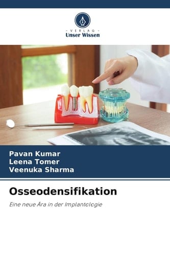 Osseodensifikation: Eine neue Ära in der Implantologie (German Edition)