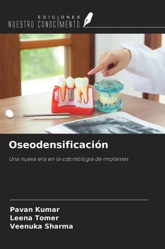 Oseodensificación: Una nueva era en la odontología de implantes (Spanish Edition)