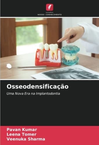Osseodensificação: Uma Nova Era na Implantodontia (Portuguese Edition)