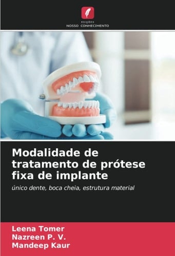 Modalidade de tratamento de prótese fixa de implante: único dente, boca cheia, estrutura material (Portuguese Edition)
