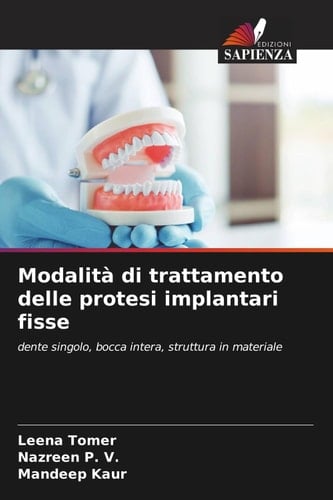Modalità di trattamento delle protesi implantari fisse: dente singolo, bocca intera, struttura in materiale (Italian Edition)