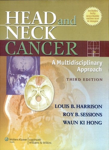 Head and Neck Cancer A Multidisciplinary Approach