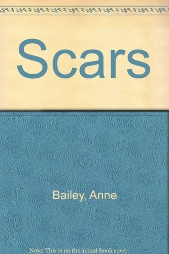 Scars