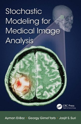 Stochastic Modeling for Medical Image Analysis