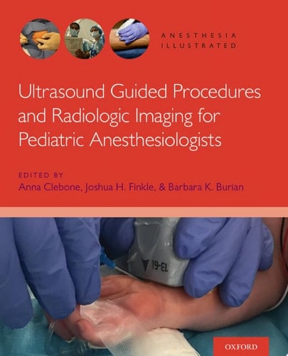 Ultrasound Guided Procedures and Radiologic Imaging for Pediatric Anesthesiologists (Anesthesia Illustrated)