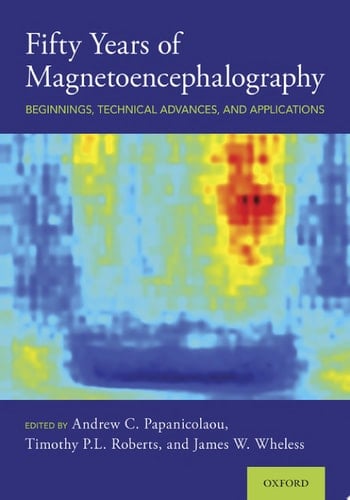 Fifty Years Of Magnetoencephalography: Beginnings, Technical Advances, And Applications
