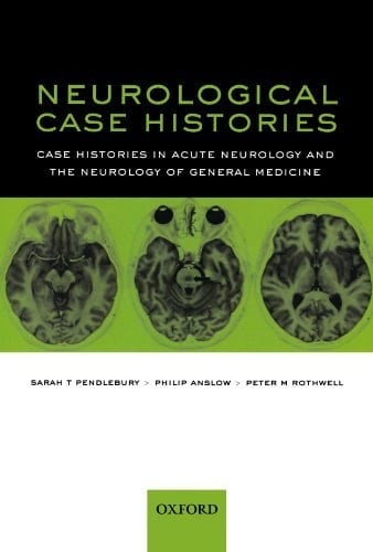 Neurological Case Histories: Case Histories in Acute Neurology and the Neurology of General Medicine (Oxford Case Histories)