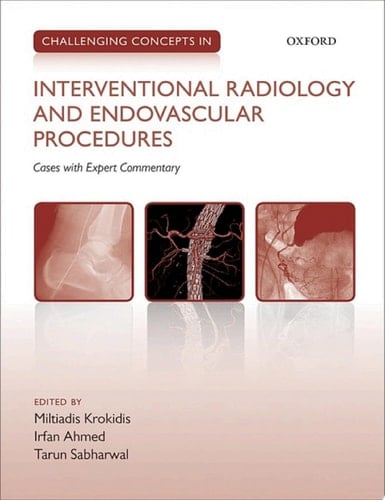 Challenging Concepts in Interventional Radiology (Challenging Cases)
