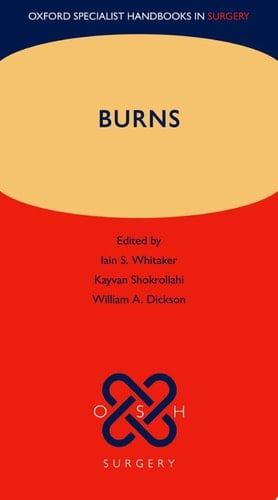 Burns (Oxford Specialist Handbooks in Surgery)