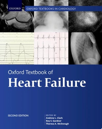 Oxford Textbook of Heart Failure (Oxford Textbooks in Cardiology)